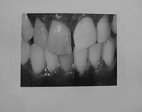 Dientes