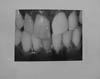 Dientes